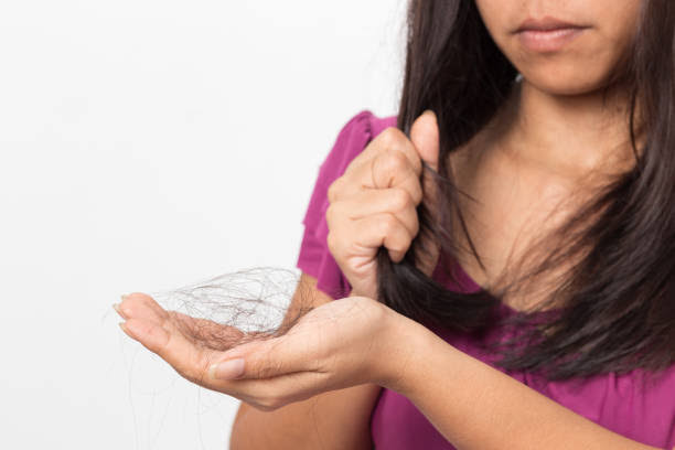 Rambut rontok adalah permasalah yang banyak dialami oleh perempuan, images sumber: iStock